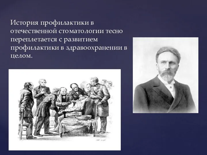 История профилактики в отечественной стоматологии тесно переплетается с развитием профилактики в здравоохранении в целом.