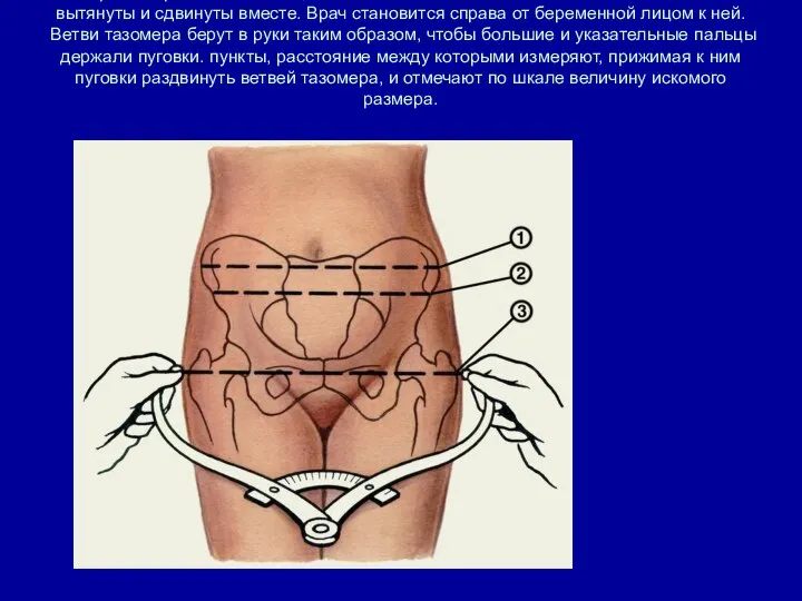 При измерении таза женщина лежит на спине с обнаженным животом, ноги вытянуты