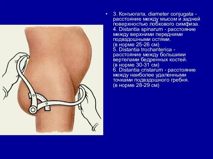 3. Конъюгата, diameter conjugata - расстояние между мысом и задней поверхностью лобкового