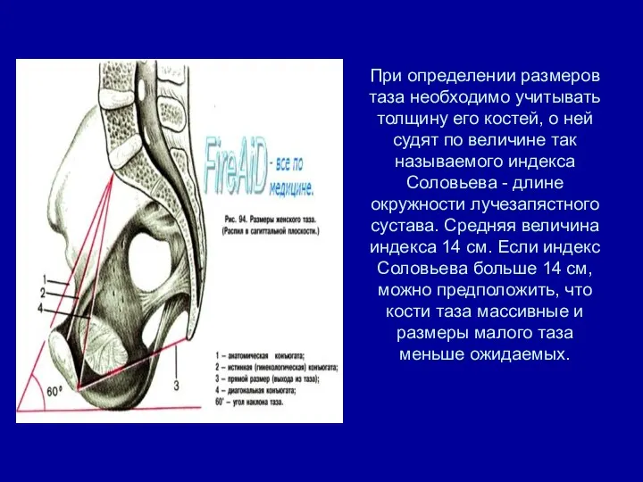 При определении размеров таза необходимо учитывать толщину его костей, о ней судят