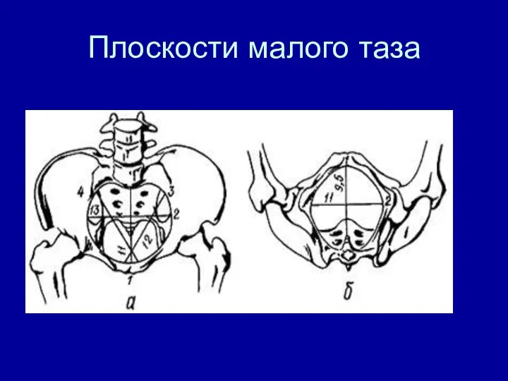 Плоскости малого таза