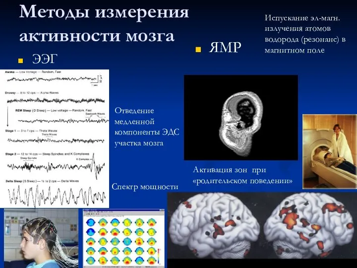 Методы измерения активности мозга ЭЭГ ЯМР Отведение медленной компоненты ЭДС участка мозга
