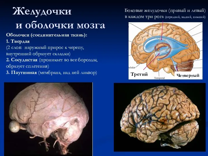 Желудочки и оболочки мозга Боковые желудочки (правый и левый) в каждом три
