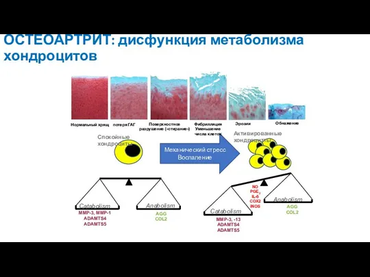 ОСТЕОАРТРИТ: дисфункция метаболизма хондроцитов Активированные хондроцитты Спокойные хондроциты Механический стресс Воспаление Нормальный