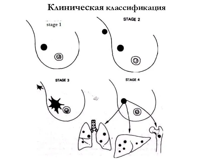 Клиническая классификация