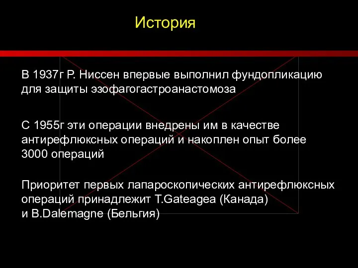 История В 1937г Р. Ниссен впервые выполнил фундопликацию для защиты эзофагогастроанастомоза С