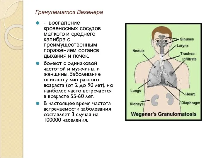 Гранулематоз Вегенера - воспаление кровеносных сосудов мелкого и среднего калибра с преимущественным