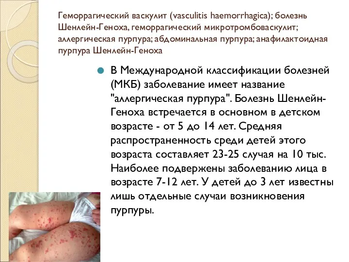 Геморрагический васкулит (vasculitis haemorrhagica); болезнь Шенлейн-Геноха, геморрагический микротромбоваскулит; аллергическая пурпура; абдоминальная пурпура;