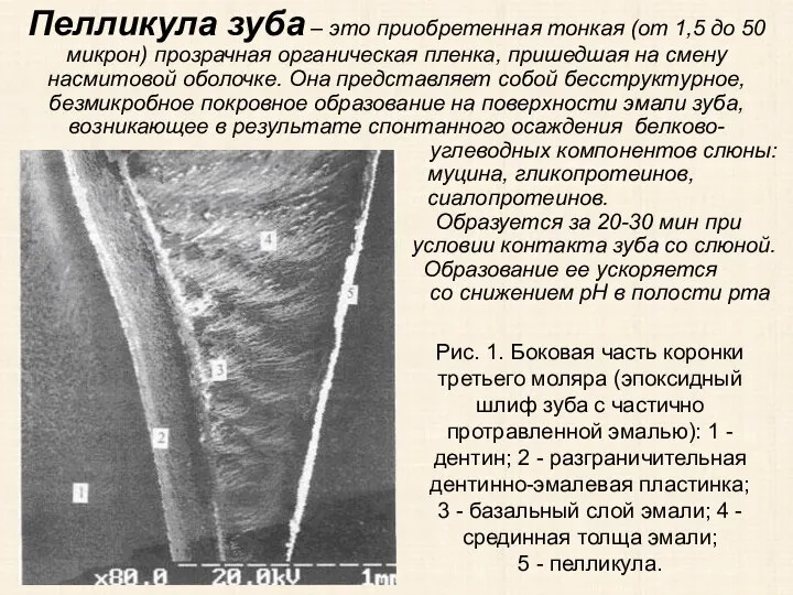 Пелликула зуба – это приобретенная тонкая (от 1,5 до 50 микрон) прозрачная