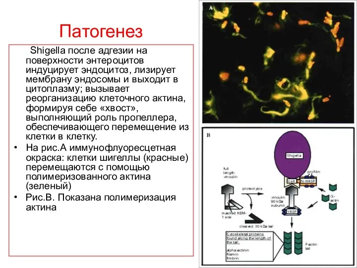 Патогенез Shigella после адгезии на поверхности энтероцитов индуцирует эндоцитоз, лизирует мембрану эндосомы