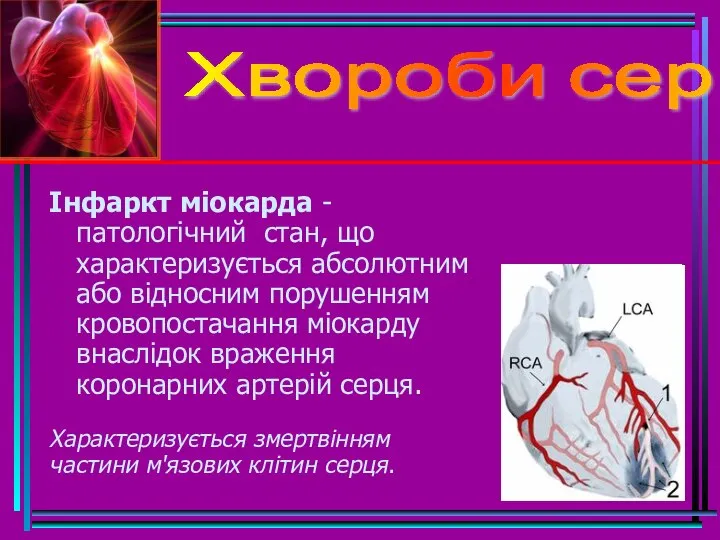 Хвороби серця Інфаркт міокарда - патологічний стан, що характеризується абсолютним або відносним