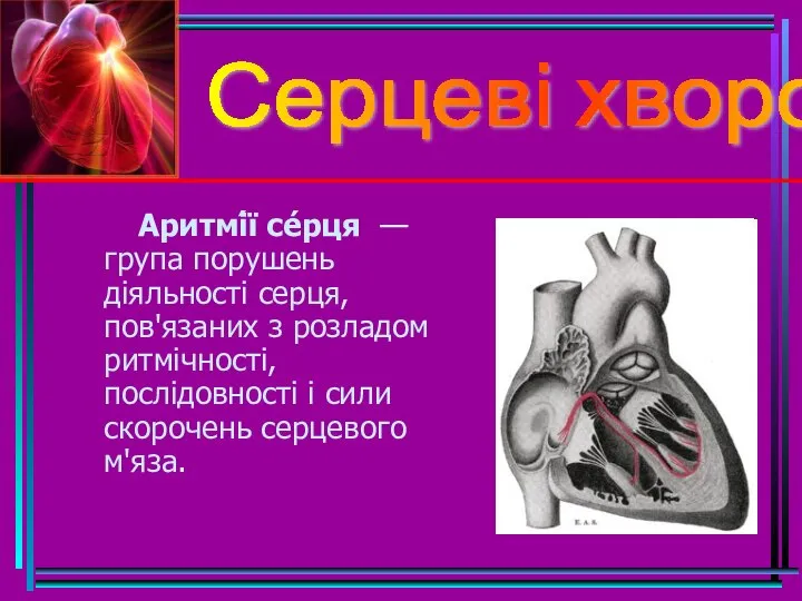 Серцеві хвороби Аритмі́ї се́рця — група порушень діяльності серця, пов'язаних з розладом