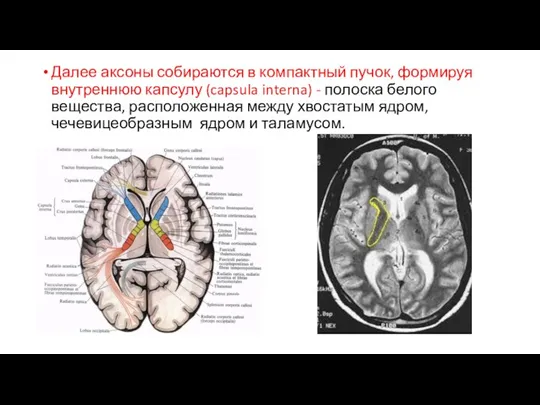 Далее аксоны собираются в компактный пучок, формируя внутреннюю капсулу (capsula interna) -