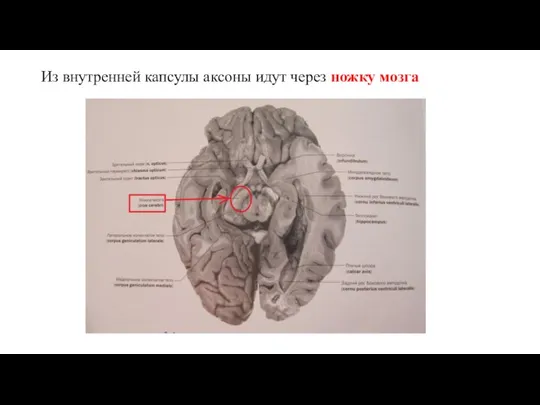 Из внутренней капсулы аксоны идут через ножку мозга