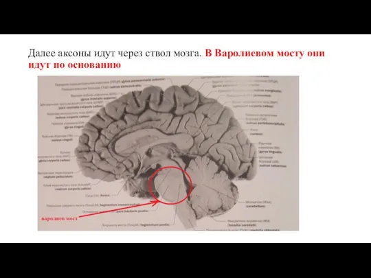Далее аксоны идут через ствол мозга. В Варолиевом мосту они идут по основанию