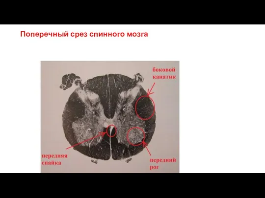 Поперечный срез спинного мозга