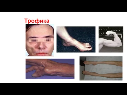 Трофика