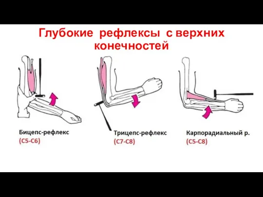 Глубокие рефлексы с верхних конечностей