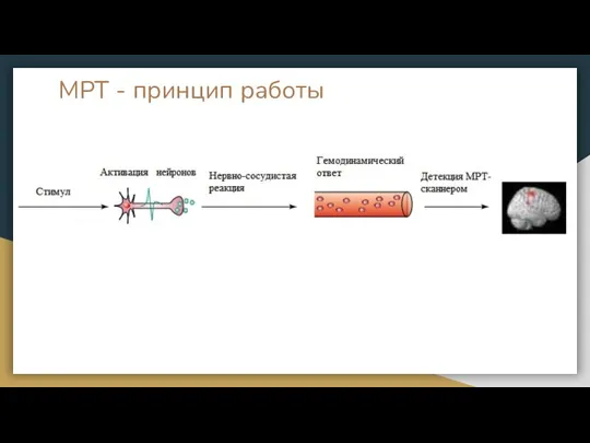 МРТ - принцип работы