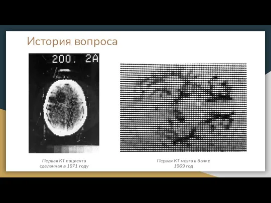 История вопроса Первая КТ пациента сделанная в 1971 году Первая КТ мозга в банке 1969 год