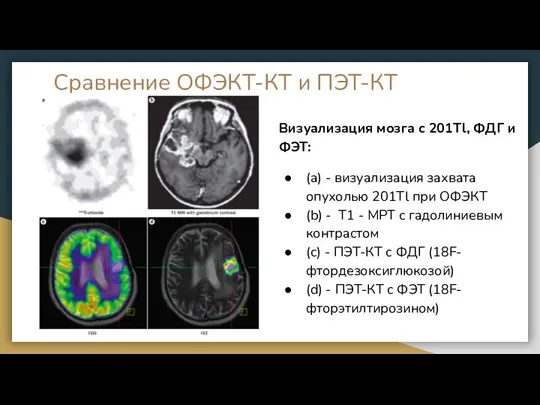 Визуализация мозга с 201Tl, ФДГ и ФЭТ: (а) - визуализация захвата опухолью