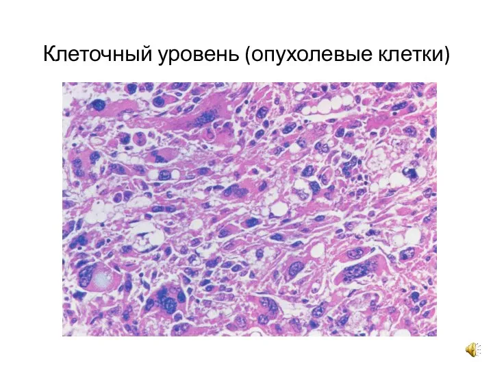 Клеточный уровень (опухолевые клетки)