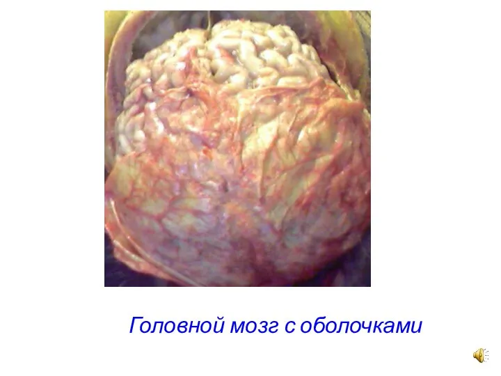 Головной мозг с оболочками