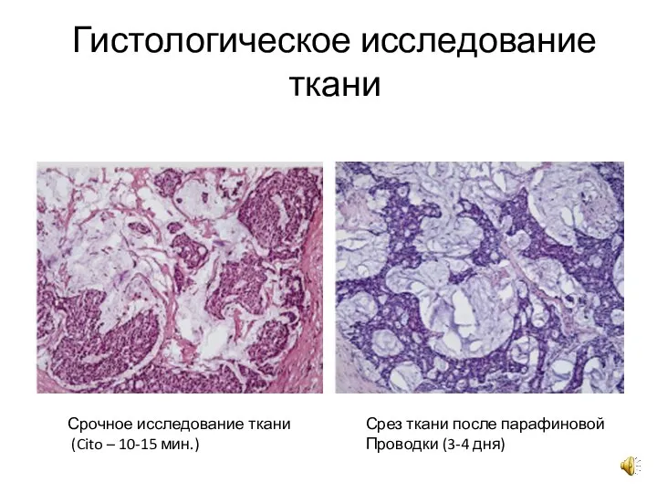 Гистологическое исследование ткани Срочное исследование ткани (Cito – 10-15 мин.) Срез ткани