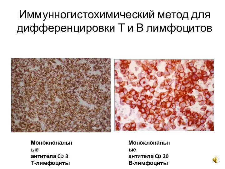 Иммунногистохимический метод для дифференцировки Т и В лимфоцитов Моноклональные антитела CD 3