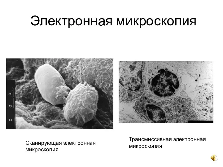 Электронная микроскопия Сканирующая электронная микроскопия Трансмиссивная электронная микроскопия