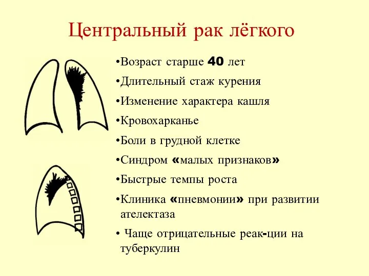 Центральный рак лёгкого Возраст старше 40 лет Длительный стаж курения Изменение характера