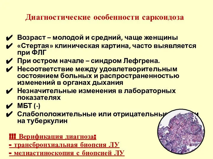 Диагностические особенности саркоидоза Возраст – молодой и средний, чаще женщины «Стертая» клиническая