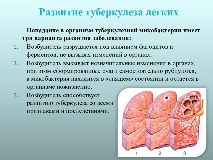 Развитие туберкулеза легких Попадание в организм туберкулезной микобактерии имеет три варианта развития
