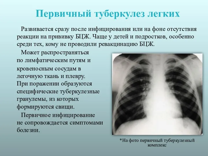 Первичный туберкулез легких Развивается сразу после инфицирования или на фоне отсутствия реакции