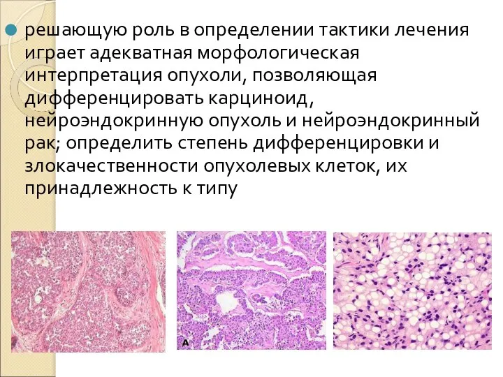 решающую роль в определении тактики лечения играет адекватная морфологическая интерпретация опухоли, позволяющая