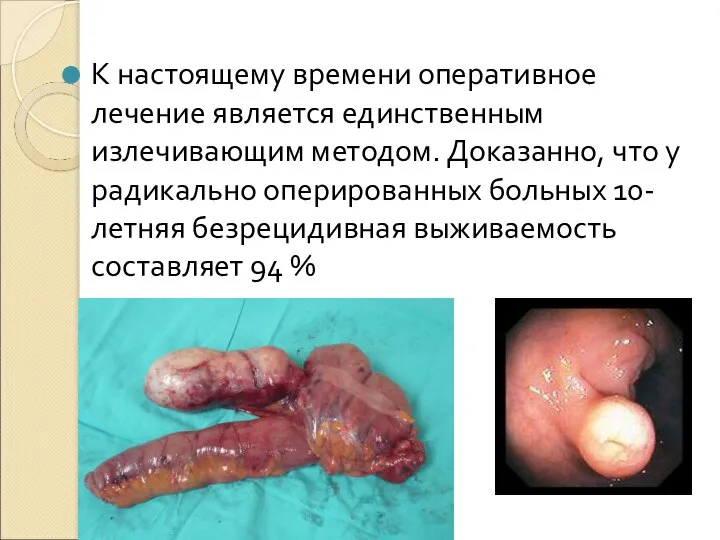 К настоящему времени оперативное лечение является единственным излечивающим методом. Доказанно, что у