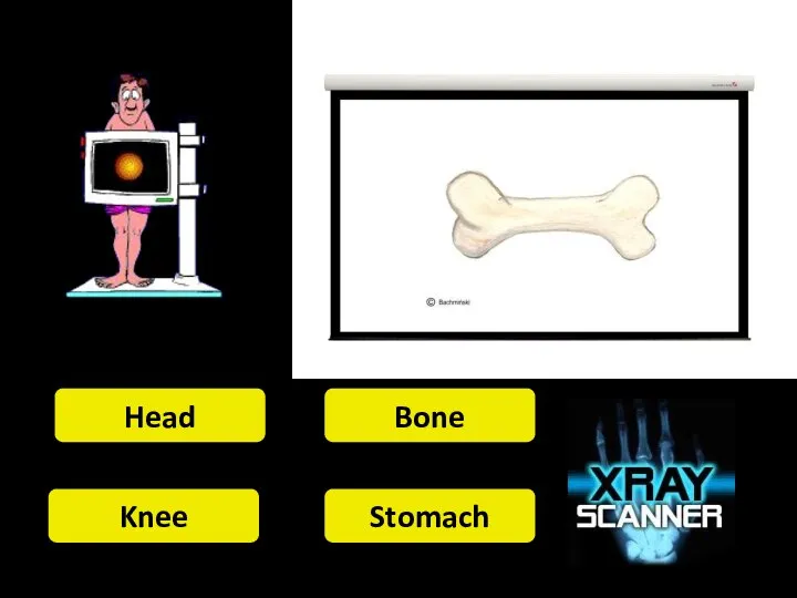 Head Bone Knee Stomach
