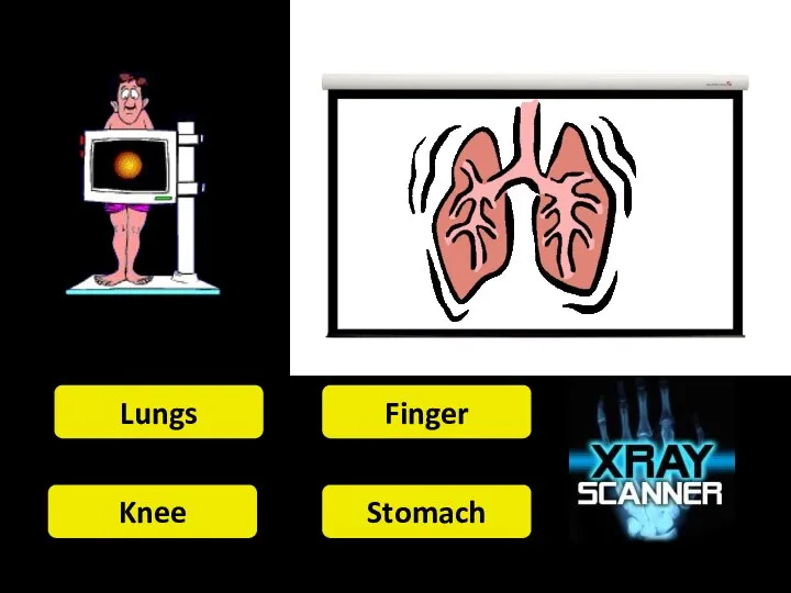 Lungs Finger Knee Stomach