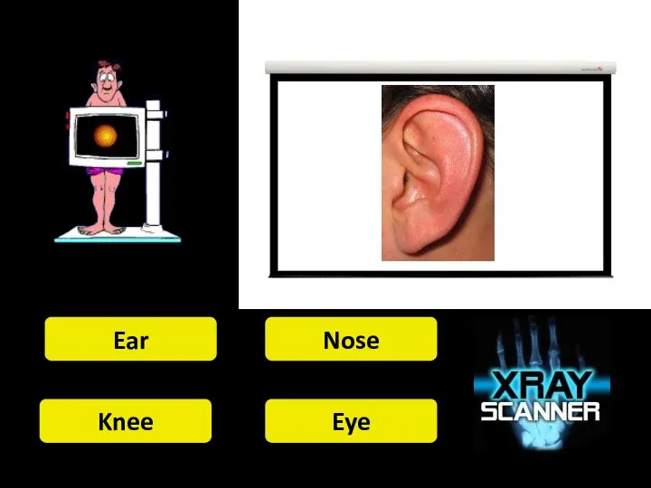 Ear Nose Knee Eye