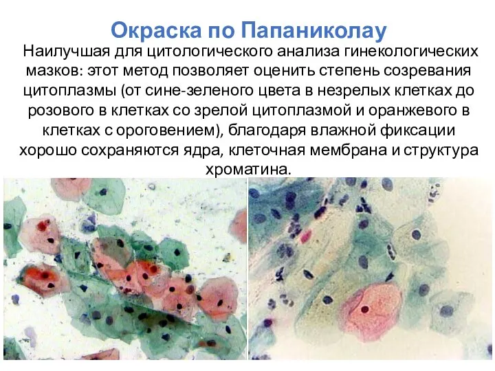 Окраска по Папаниколау Наилучшая для цитологического анализа гинекологических мазков: этот метод позволяет