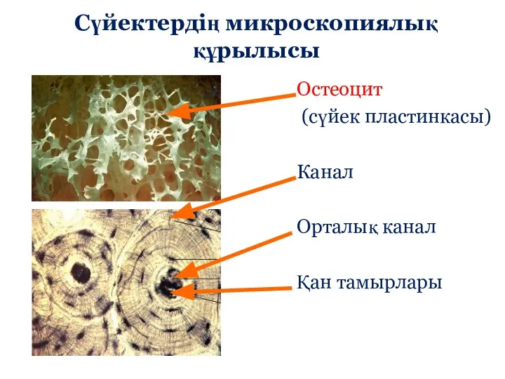 Сүйектердің микроскопиялық құрылысы Остеоцит (сүйек пластинкасы) Канал Орталық канал Қан тамырлары