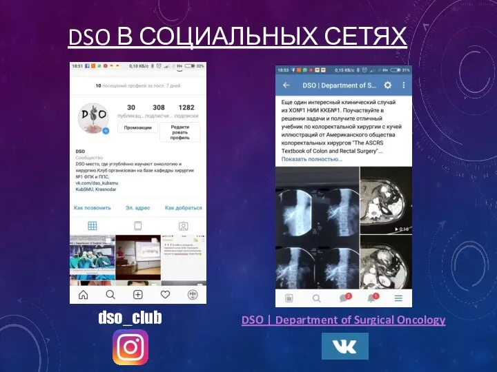 DSO В СОЦИАЛЬНЫХ СЕТЯХ dso_club DSO | Department of Surgical Oncology