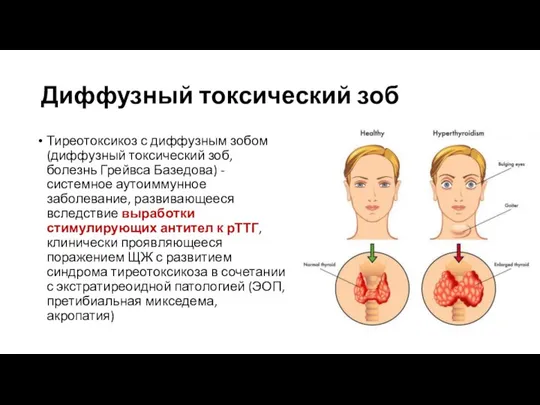 Диффузный токсический зоб Тиреотоксикоз с диффузным зобом (диффузный токсический зоб, болезнь Грейвса