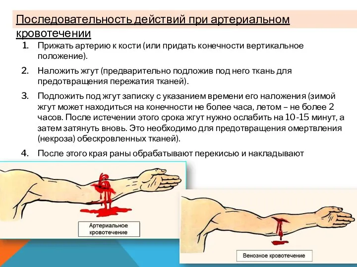 Прижать артерию к кости (или придать конечности вертикальное положение). Наложить жгут (предварительно