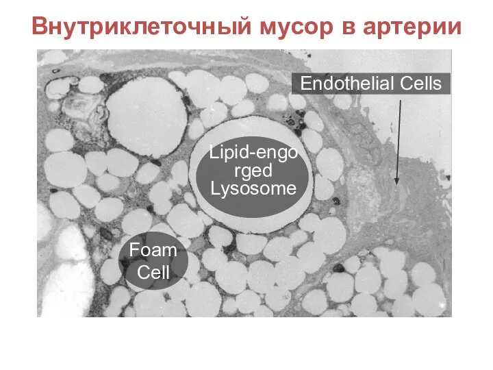 Endothelial Cells Lipid-engorged Lysosome Foam Cell Внутриклеточный мусор в артерии