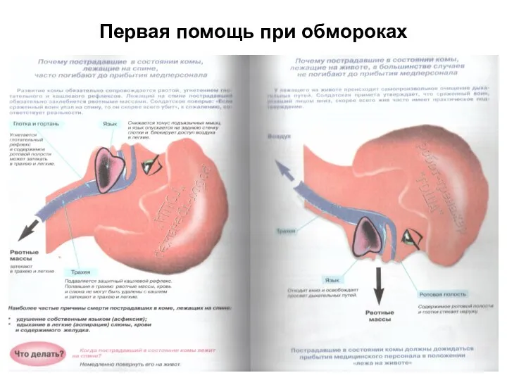 Первая помощь при обмороках