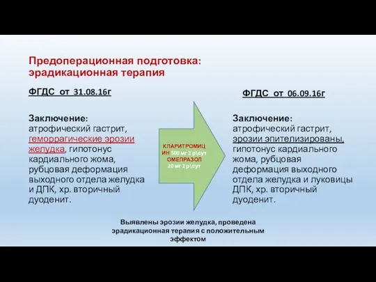 Предоперационная подготовка: эрадикационная терапия ФГДС от 31.08.16г Заключение: атрофический гастрит, геморрагические эрозии