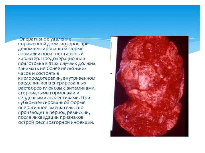 Оперативное удаление пораженной доли, которое при декомпенсированной форме аномалии носит неотложный характер.