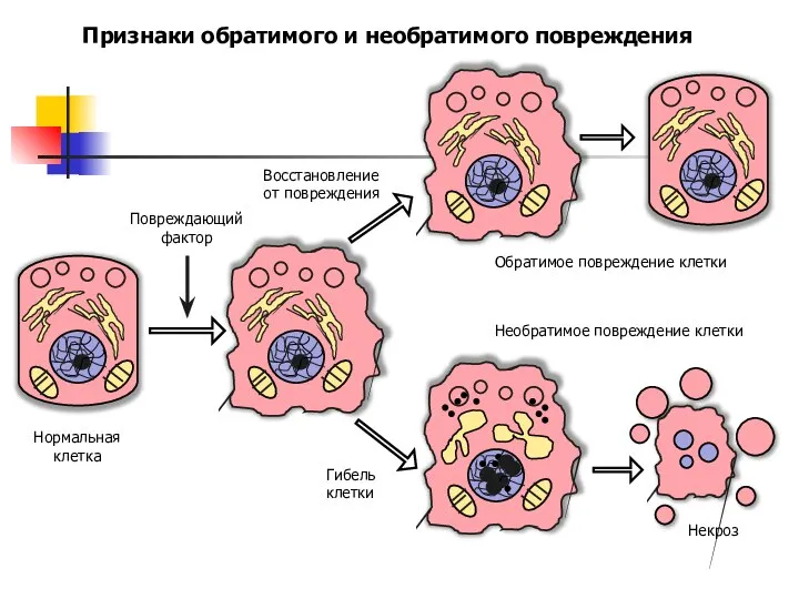 Признаки обратимого и необратимого повреждения Повреждающий фактор Нормальная клетка Гибель клетки Обратимое