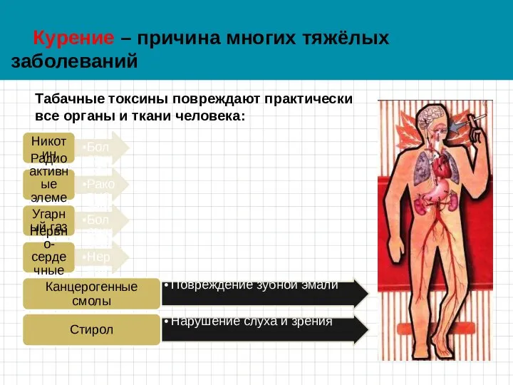 Курение – причина многих тяжёлых заболеваний Табачные токсины повреждают практически все органы